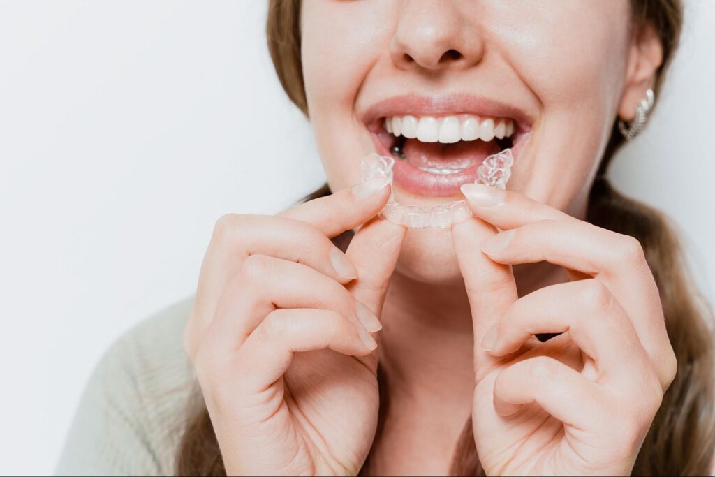 Choosing Between Metal & Clear Braces